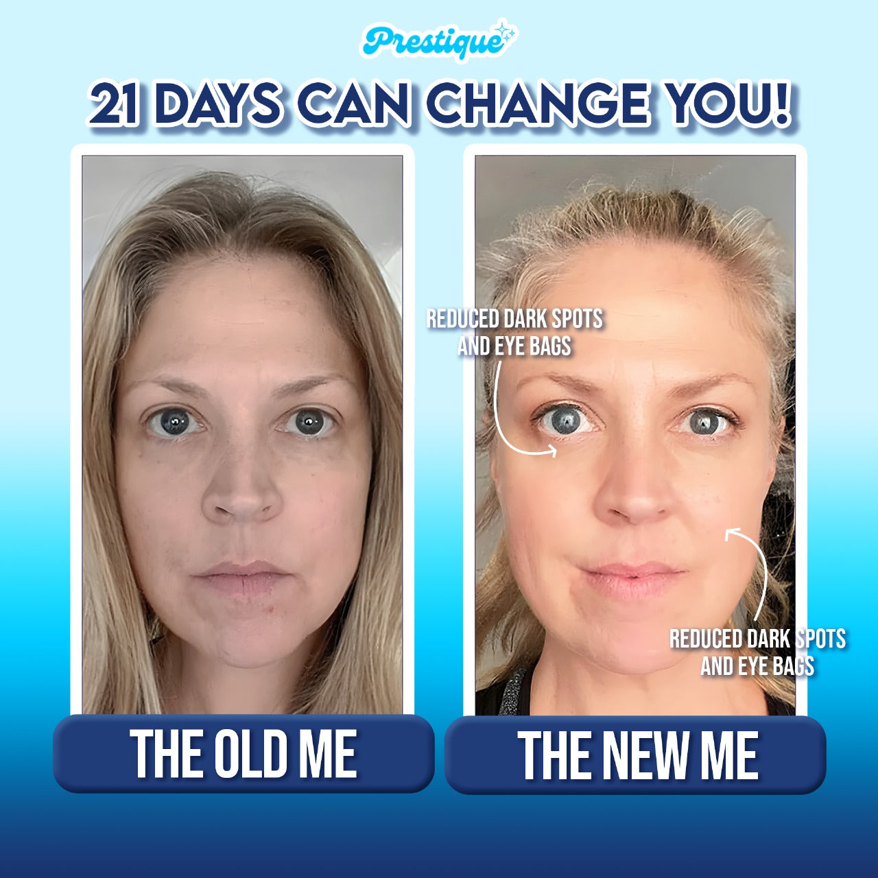 NeckLift™ - Sculpting Device