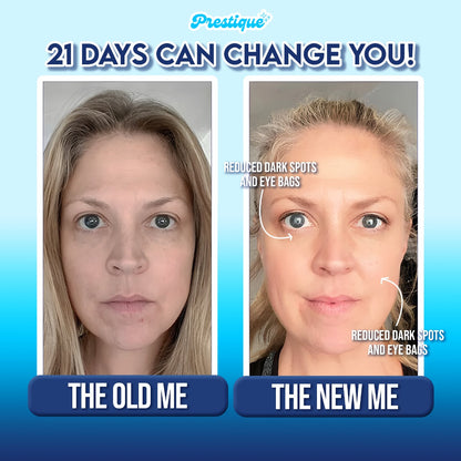 NeckLift™ - Sculpting Device